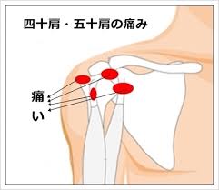 イメージ画像